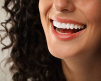 Teeth Whitening in Riyadh